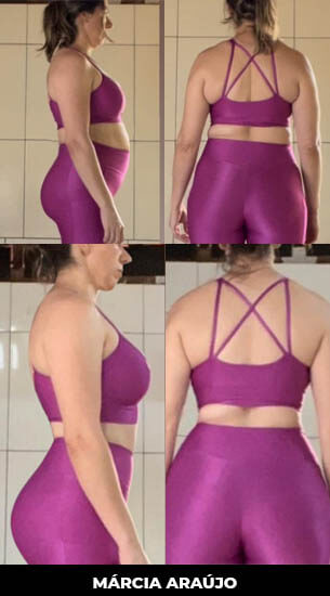 Antes x Depois - Márcia